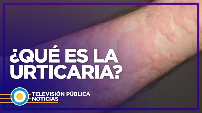 Guía de Compra: Alimentos Sin Gluten en Caspe